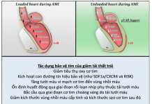 Quản lý nhồi máu cơ tim: Những hướng đi mới trong tương lai