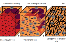 Vai trò của cộng hưởng từ tim trong hội chứng động mạch vành mạn – P2
