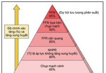 Thực hành dựa trên bằng chứng trong phòng thông tim: Đánh giá xâm lấn sinh lý mạch vành thượng tâm mạc – P1