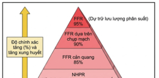 Thực hành dựa trên bằng chứng trong phòng thông tim: Đánh giá xâm lấn sinh lý mạch vành thượng tâm mạc – P1